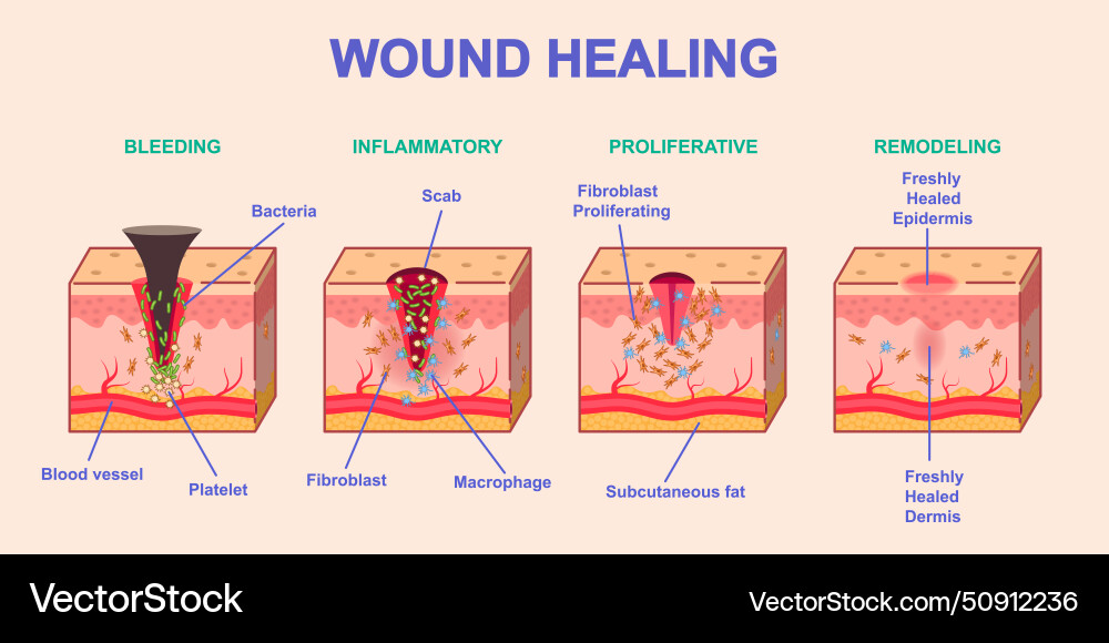 wound-healing-process-royalty-free-vector-image