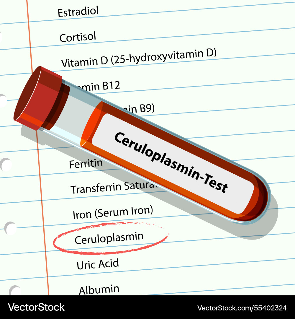 Image of a blood test tube and list Image of a blood test tube and list vector image