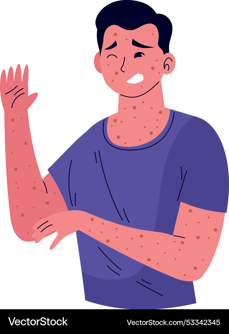 Man character with monkeypox virus Vector Image
