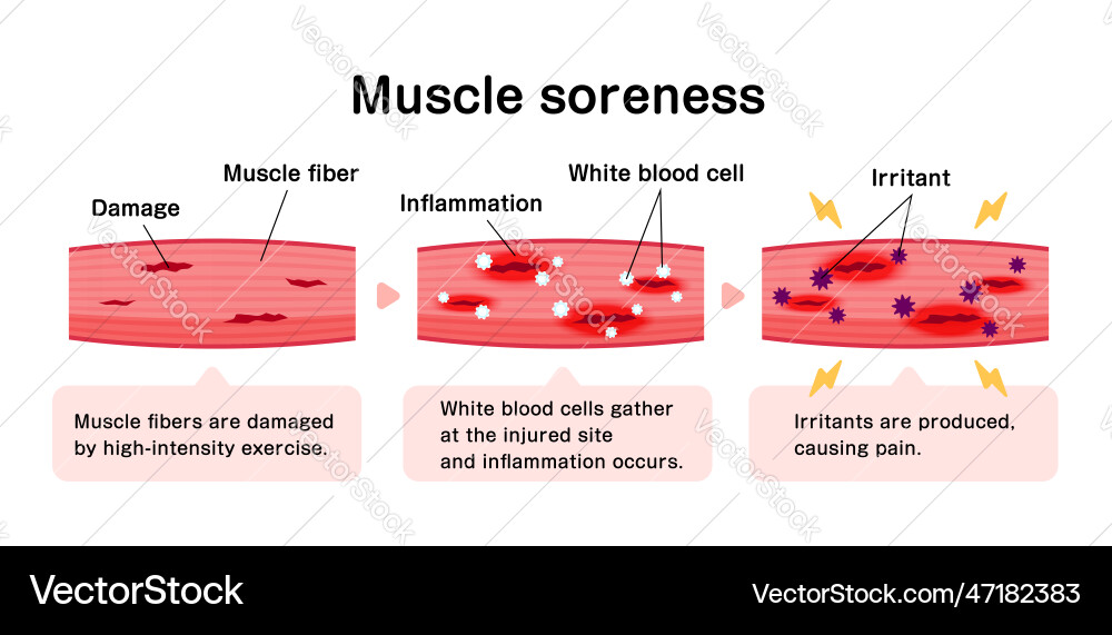 Mechanism of muscle soreness Mechanism of muscle soreness vector image