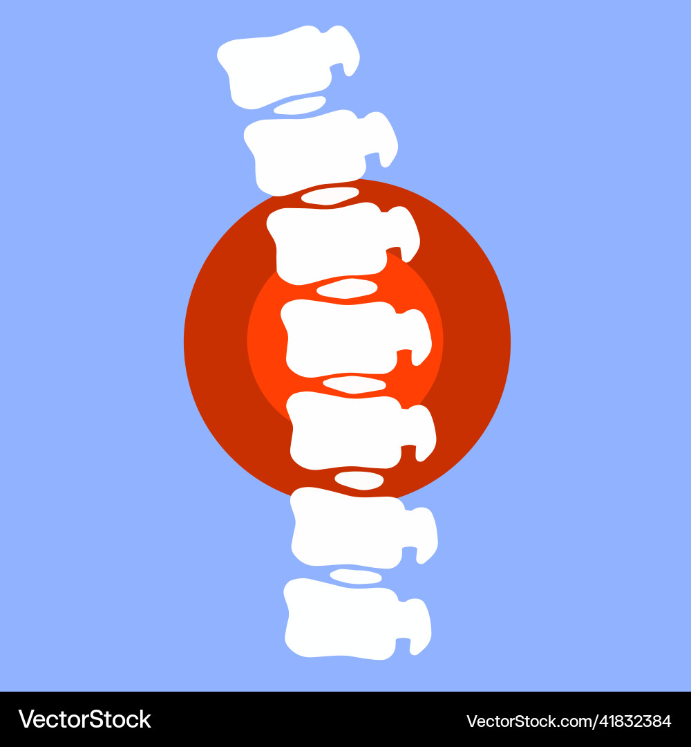Problems with spine fracture vector image