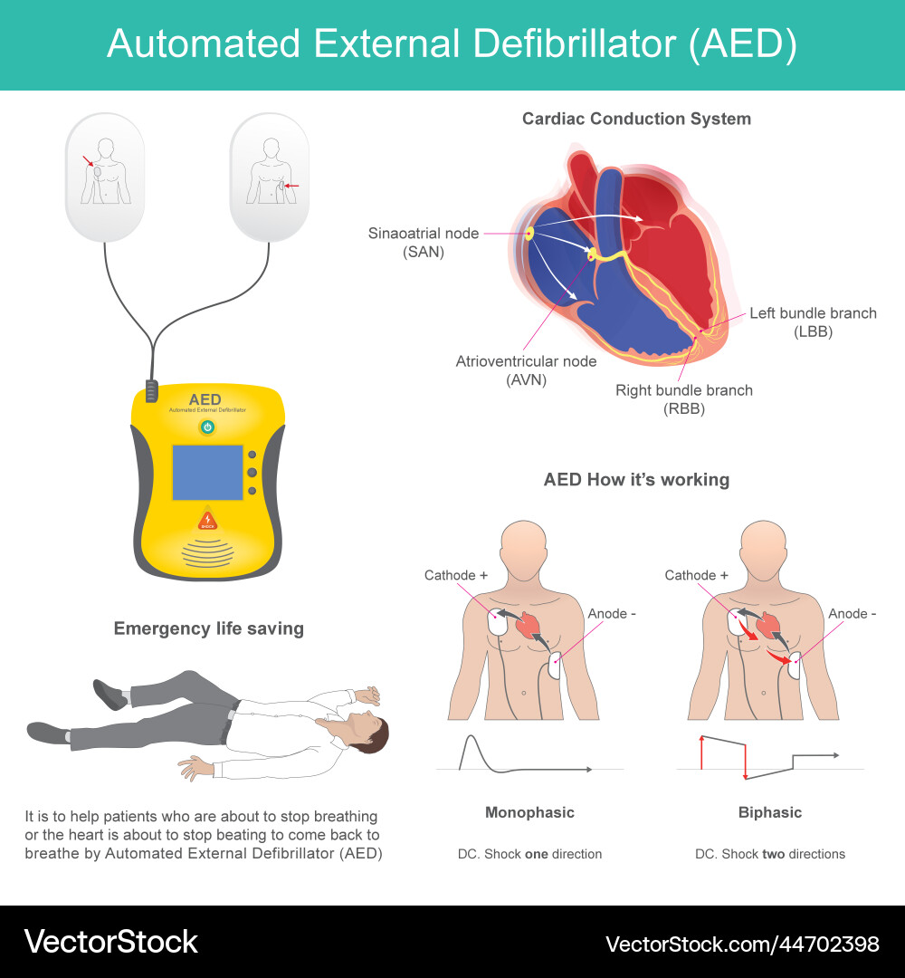 Automated external defibrillator vector image