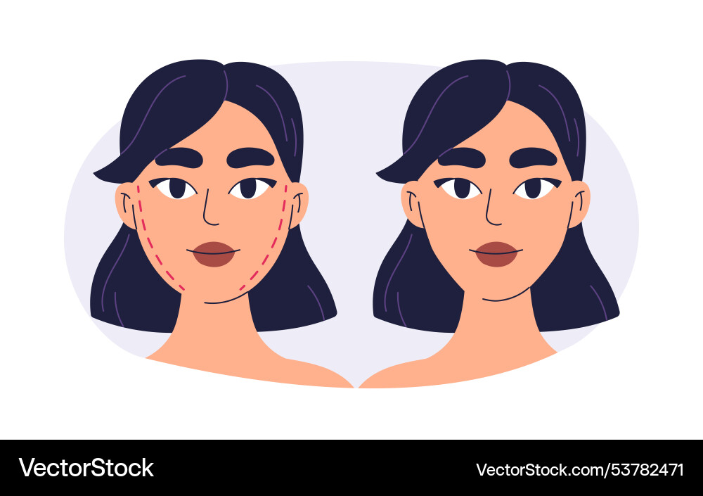 Plastic surgery face transformation before after Plastic surgery face transformation before after vector image
