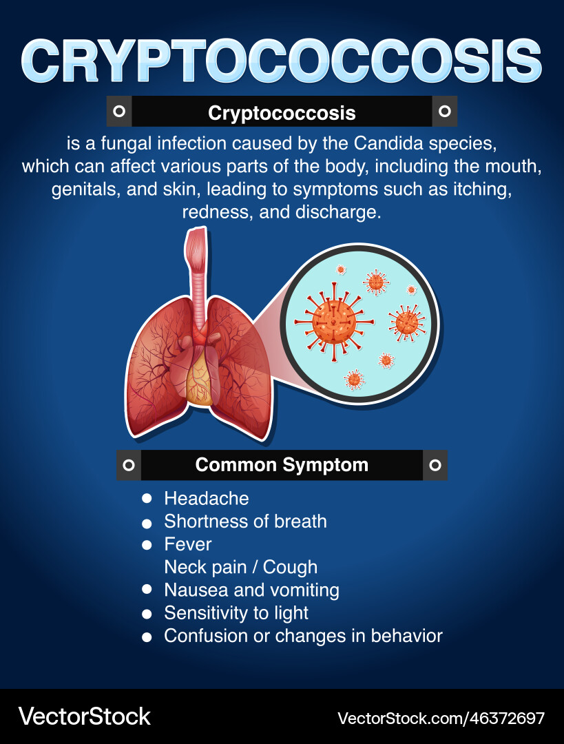 Cryptococcosis: Symptoms & Information – Royalty-Free Vector | VectorStock