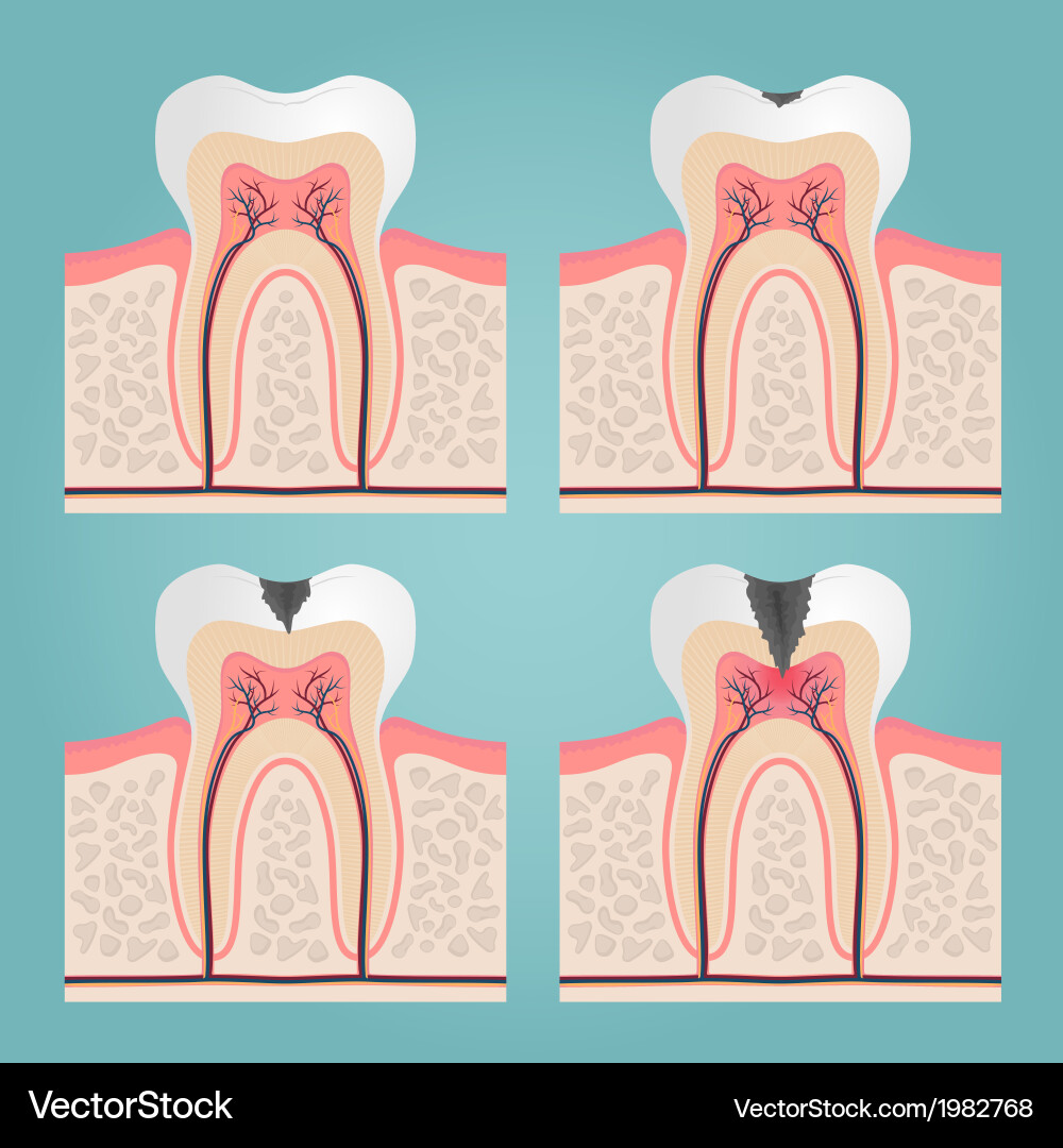 Tooth anatomy Vector Image