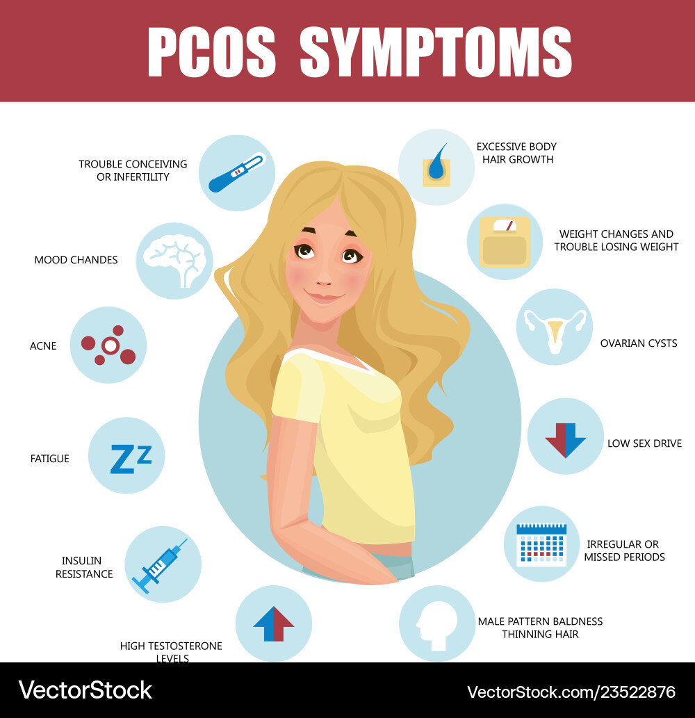 Polyzystisches Ovary-Syndrom PCOS Symptome Vektorbild