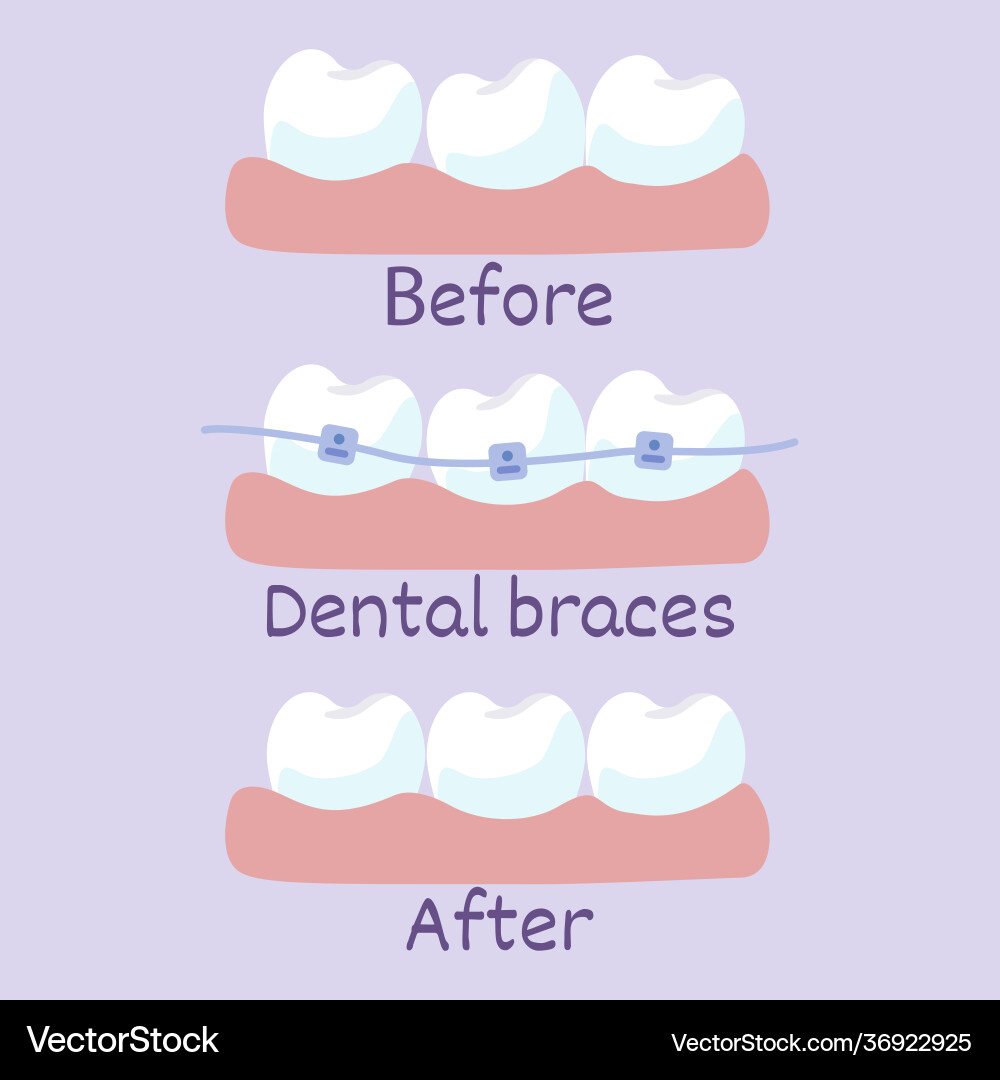 Before after correction brackets Vector Image