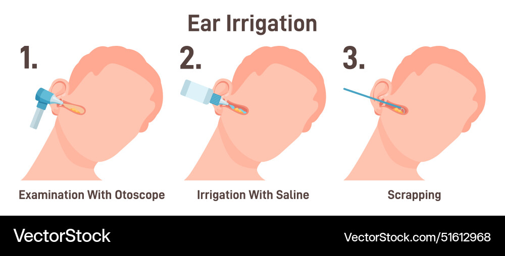 Ent doctor irrigate ears checking ear Royalty Free Vector