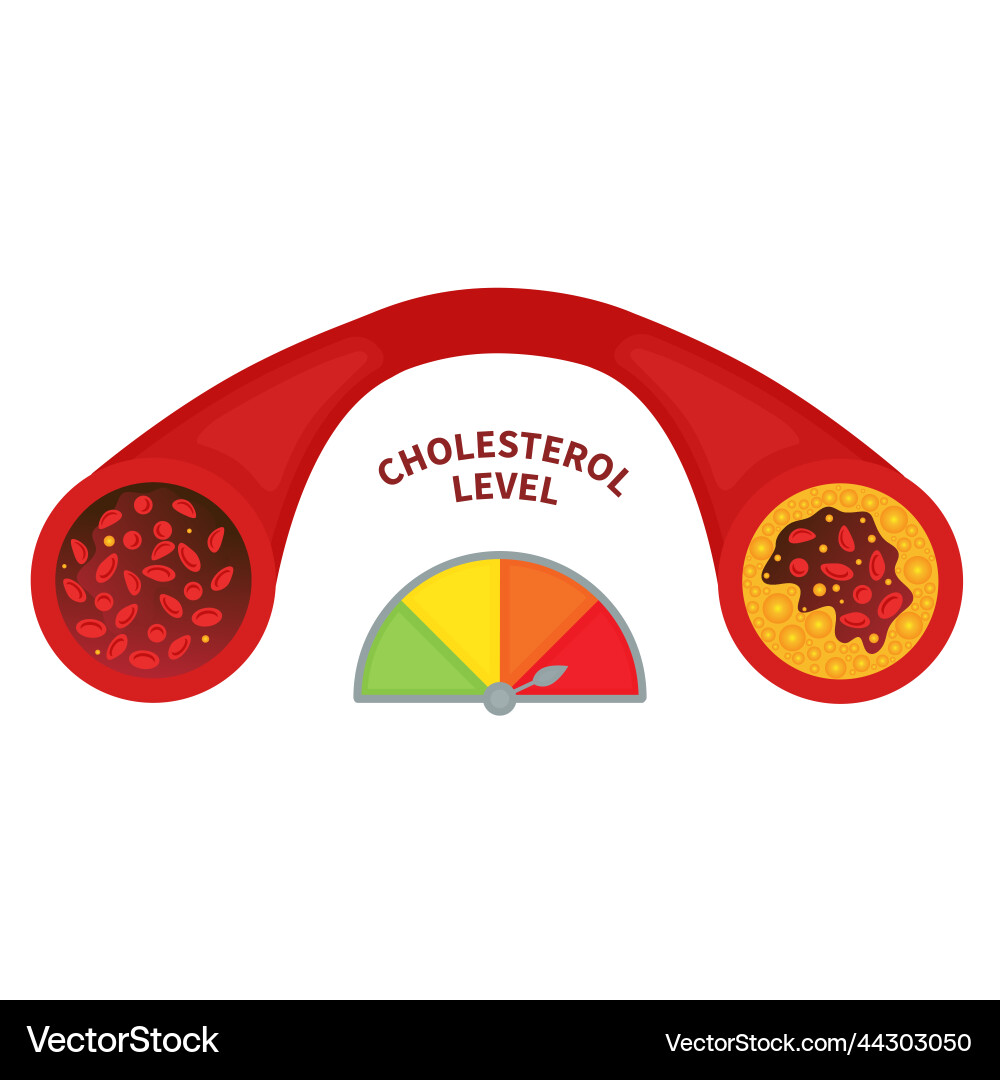 Cholesterol Level Meter - HDL & LDL vector image