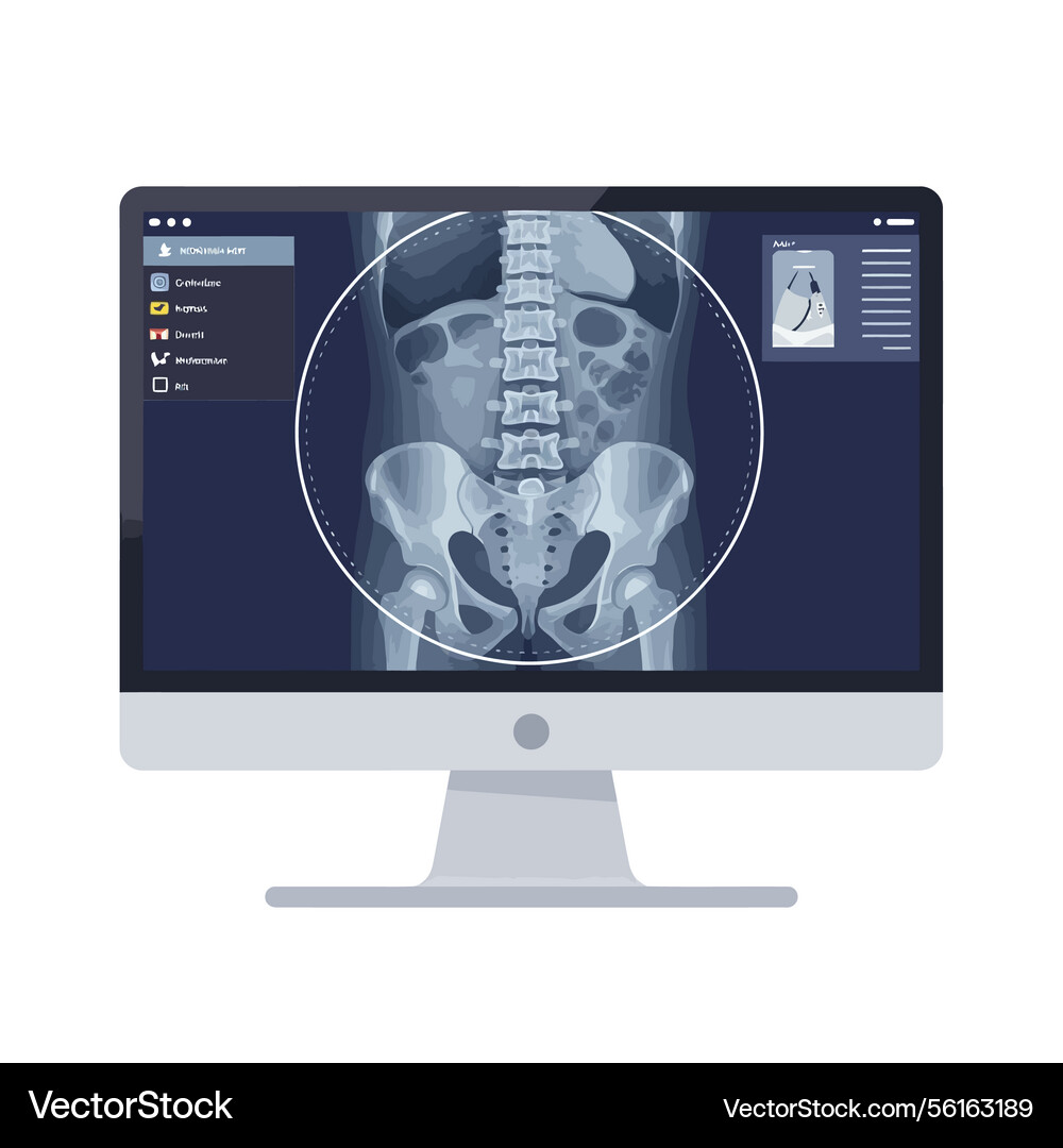 Digital of an x-ray display on a computer monitor Digital of an x-ray display on a computer monitor Vector Image
