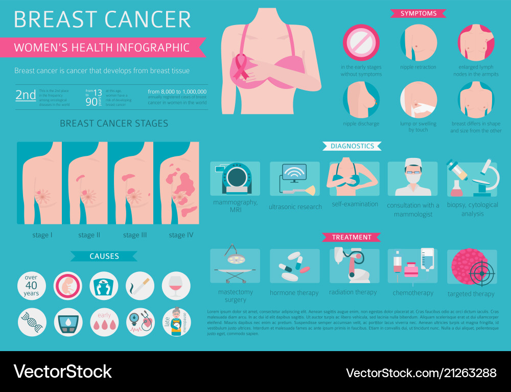 Brustkrebs medizinische Infografikdiagnostik Brustkrebs medizinische Infografikdiagnostik vektorbild