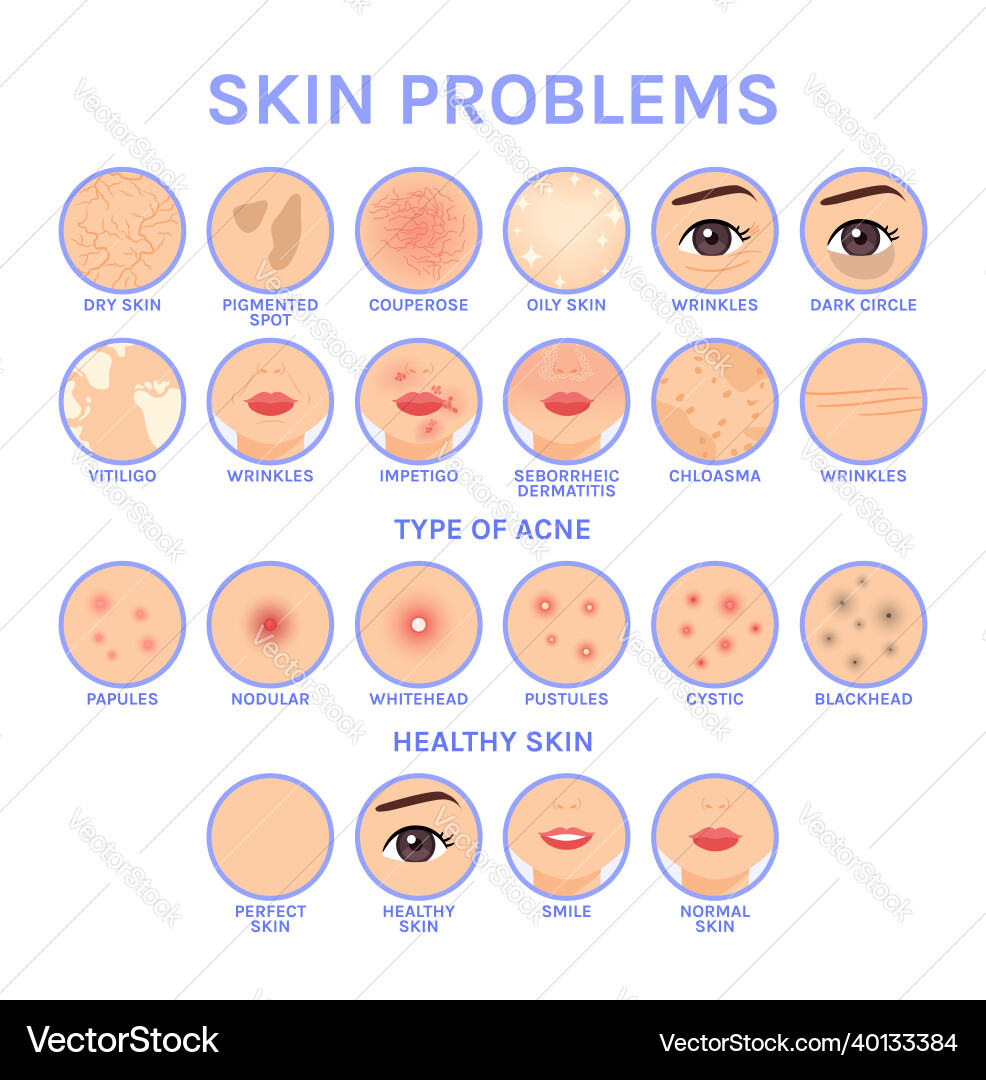 Skin problems set of icons for different Skin problems set of icons for different vector image