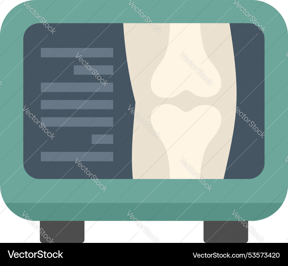 X ray machine showing knee bones scan result X ray machine showing knee bones scan result vector image