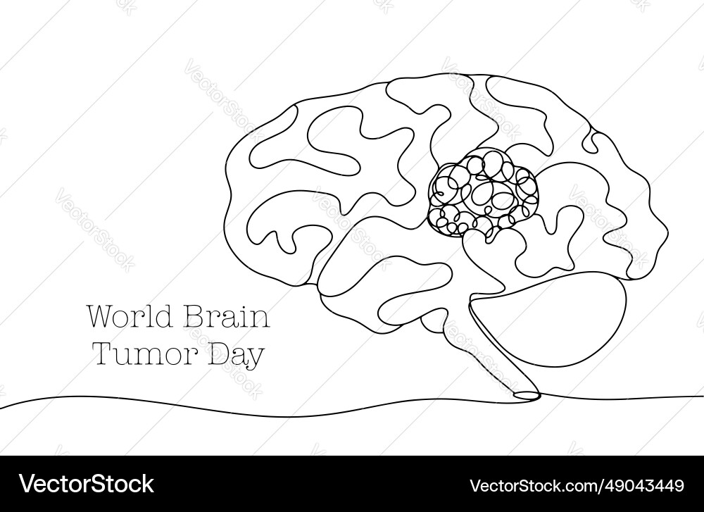 Brain tumor disease one line Brain tumor disease one line vector image