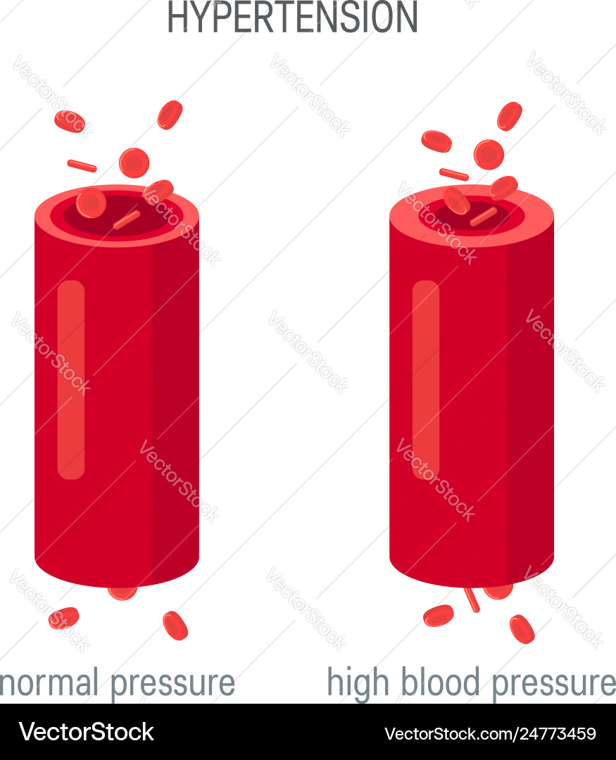 Blood pressure concept in flat style Blood pressure concept in flat style vector image