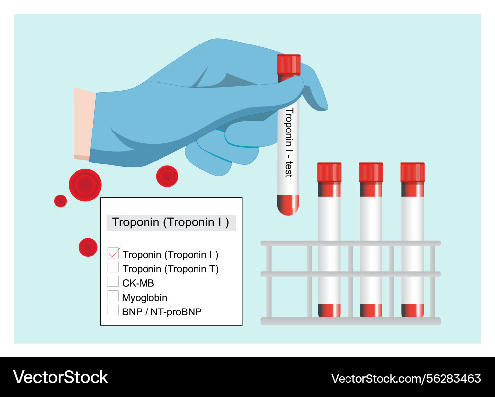 Troponin i is a highly specific and sensitive Troponin i is a highly specific and sensitive vector image