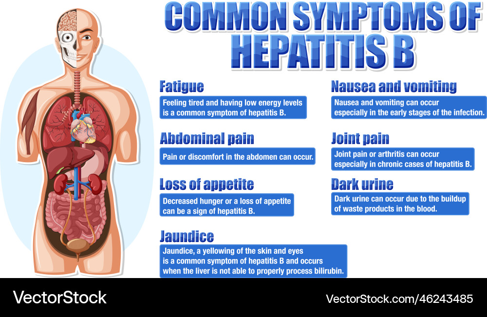 Informative Poster of Common Symptome Hepatitis B Informative Poster of Common Symptome Hepatitis B vektorbild