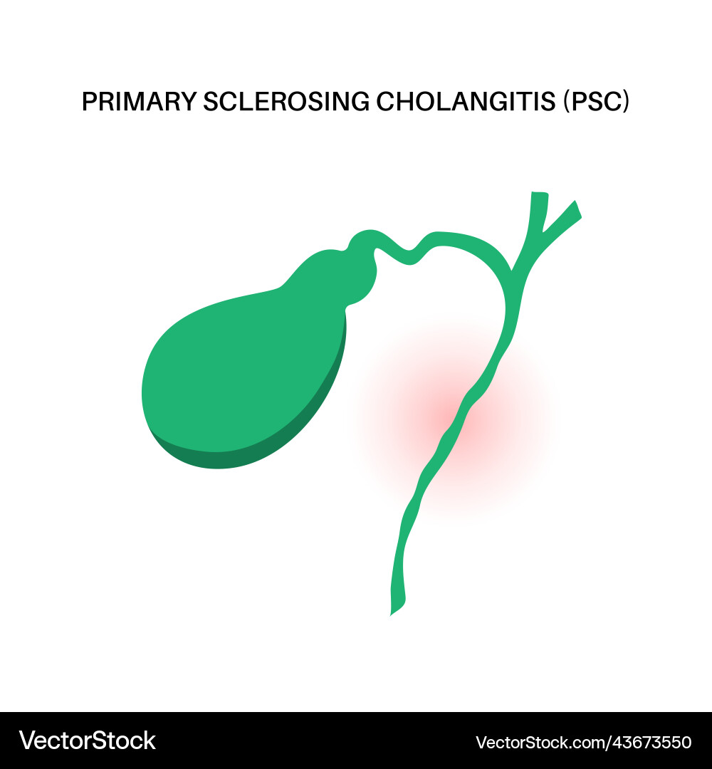 Primary Sclerosing Cholangitis (PSC) vector image