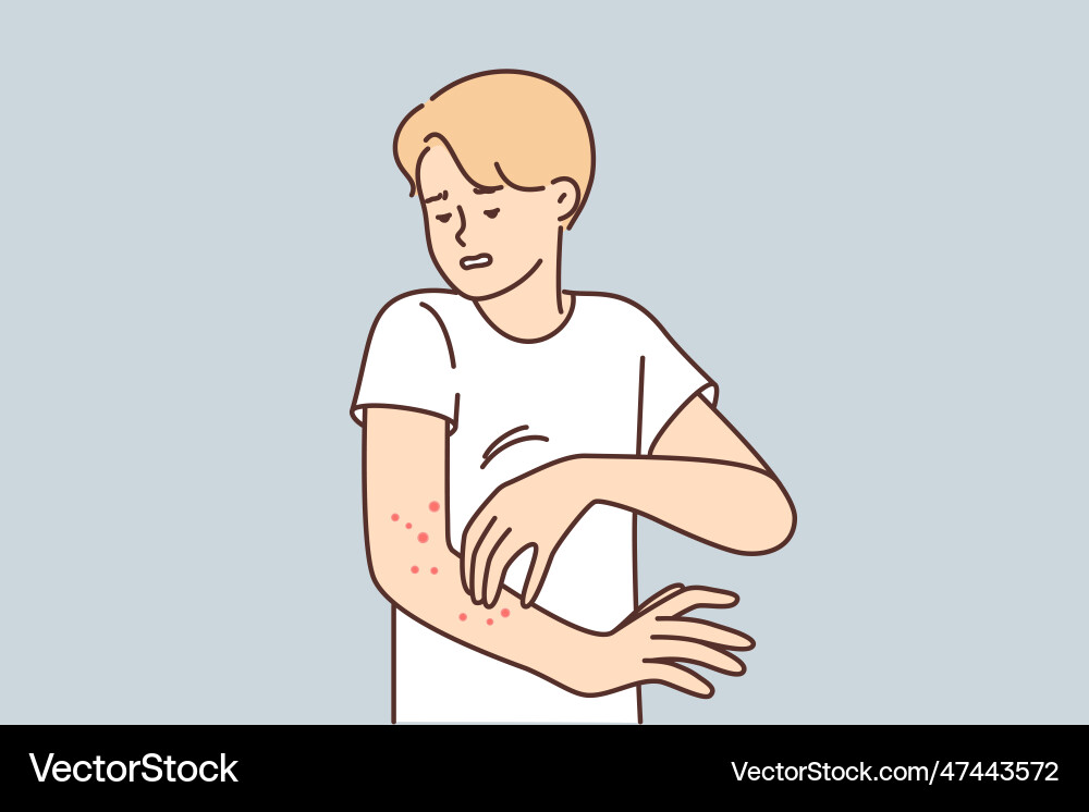 Man with rash on arm suffers from itching Vector Image