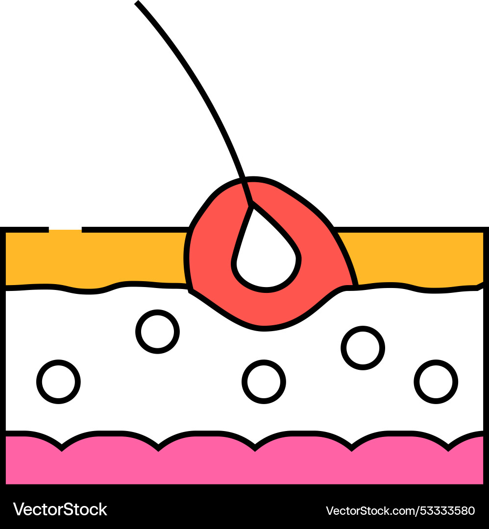 Folliculitis skin disease problem icon color Folliculitis skin disease problem icon color vector image