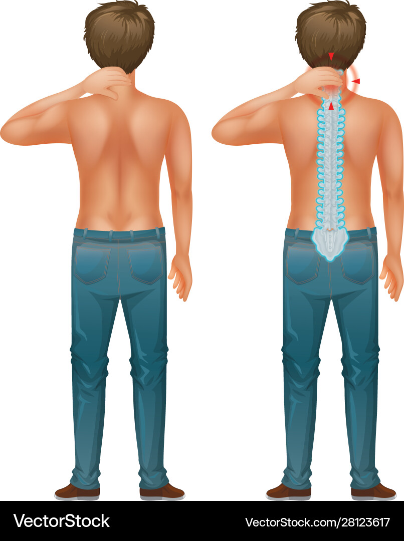 Back man with spinal nerve problem Back man with spinal nerve problem vector image