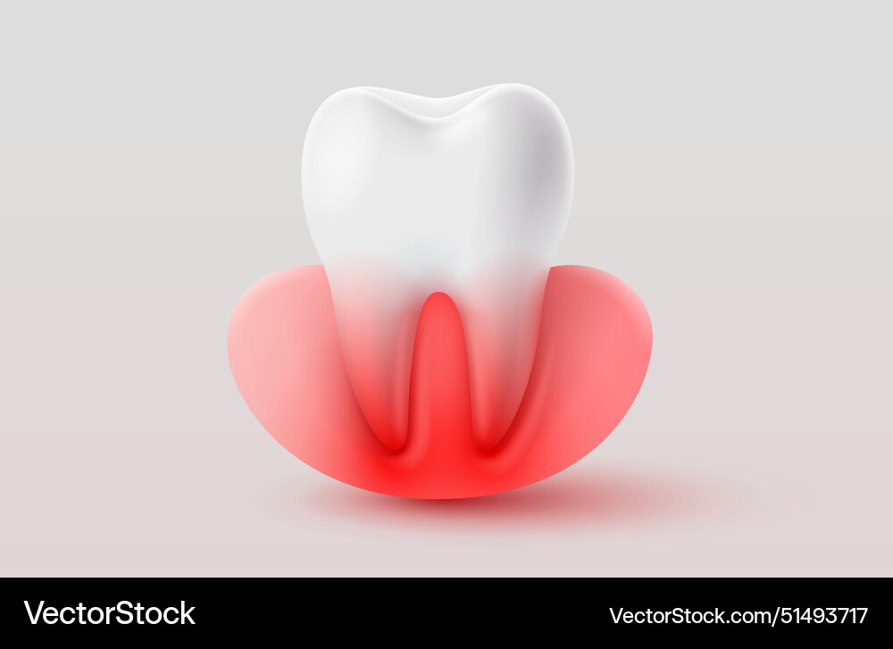 Dental inflammation treatment of tooth roots Dental inflammation treatment of tooth roots vector image