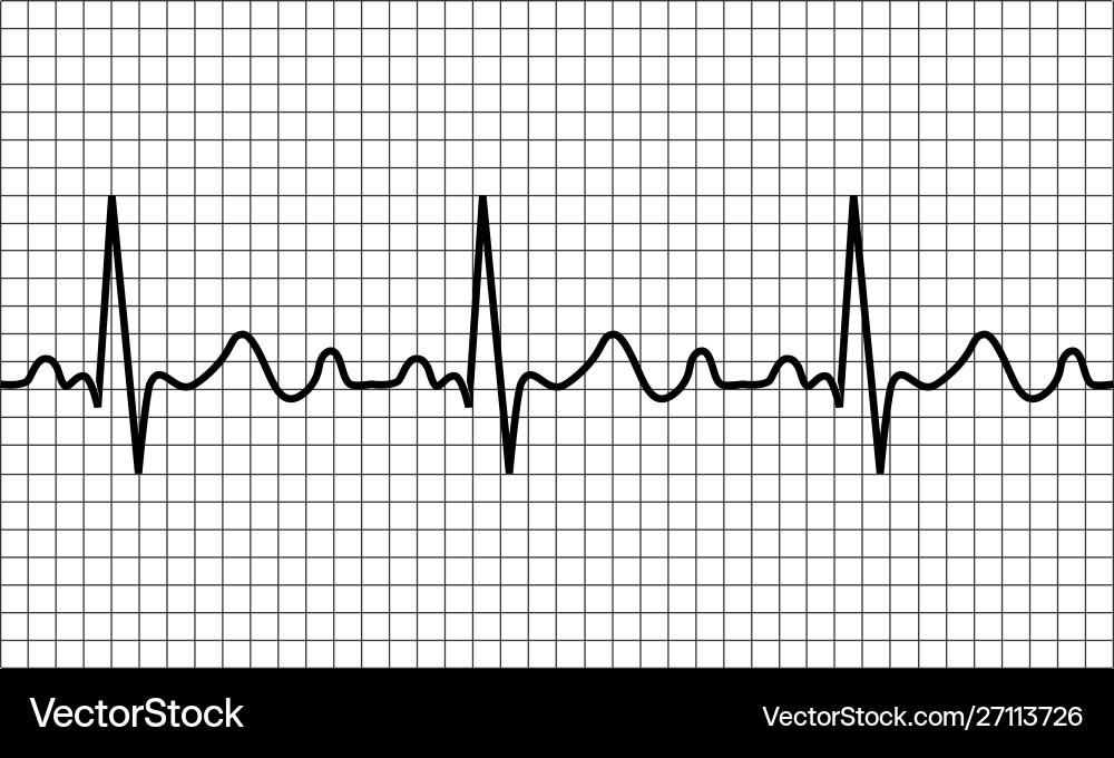 Herzschlag-Ikone ecg pathology trace Herzschlag-Ikone ecg pathology trace vektorbild