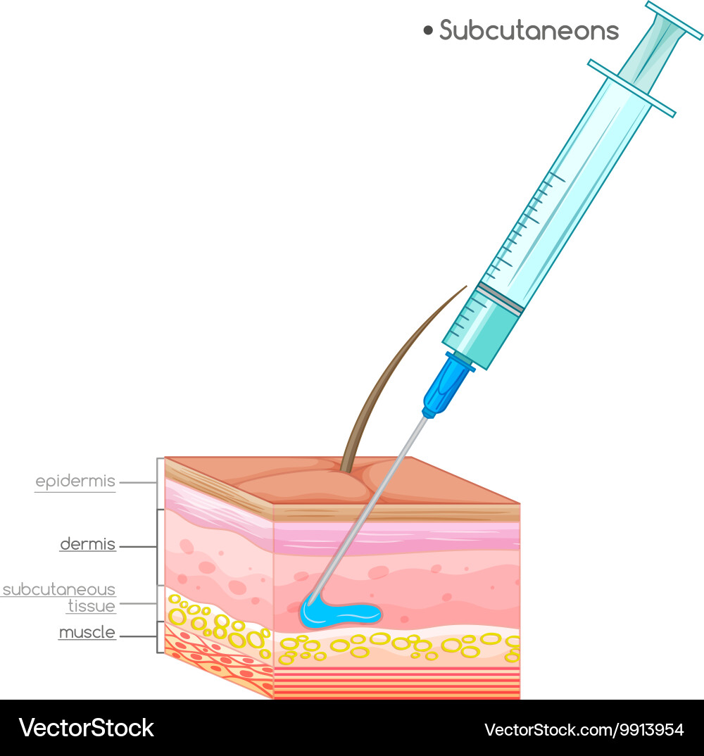 Diagram showing subcutaneons injection Vector Image