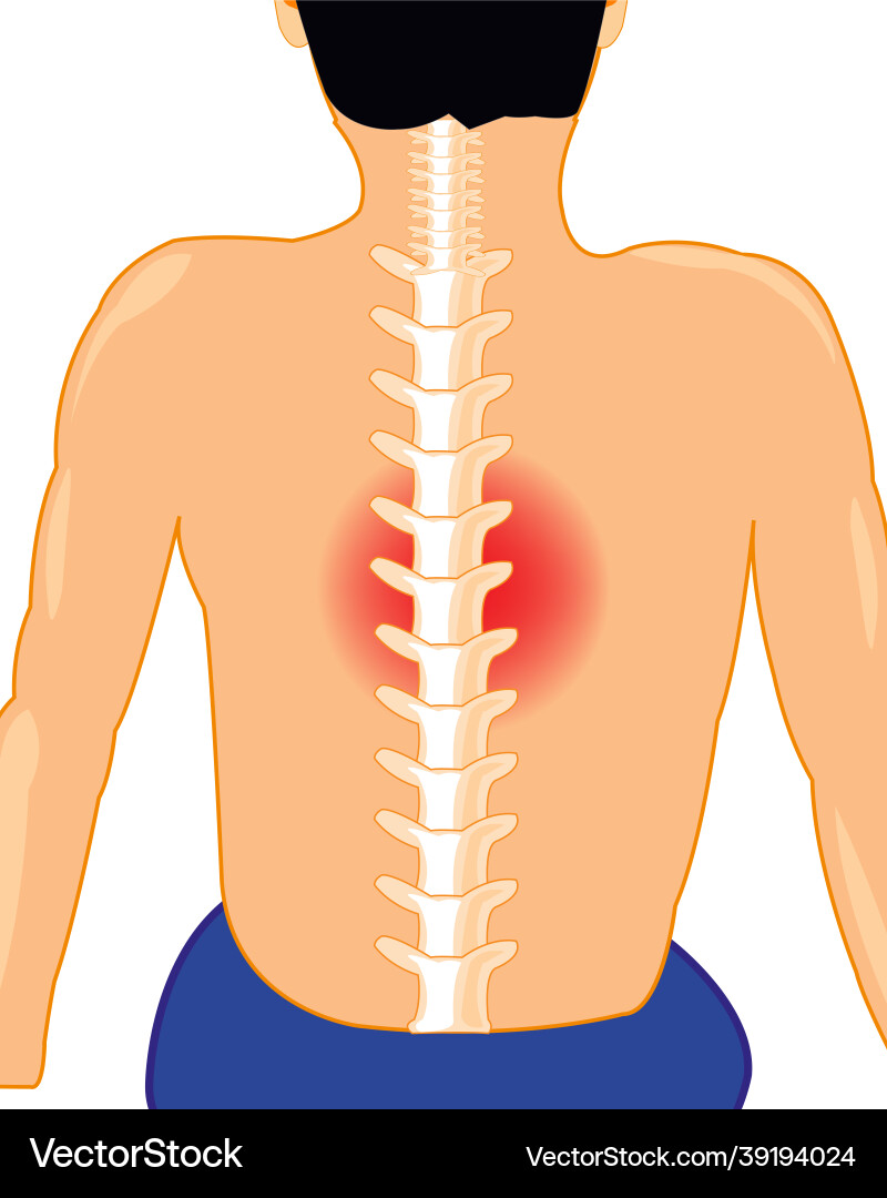 Man with sick spine on white background Vector Image