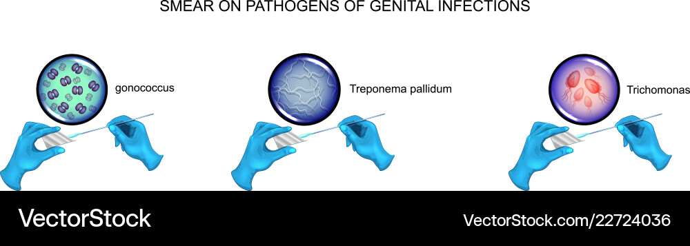 Urological smear pathogens Urological smear pathogens vector image