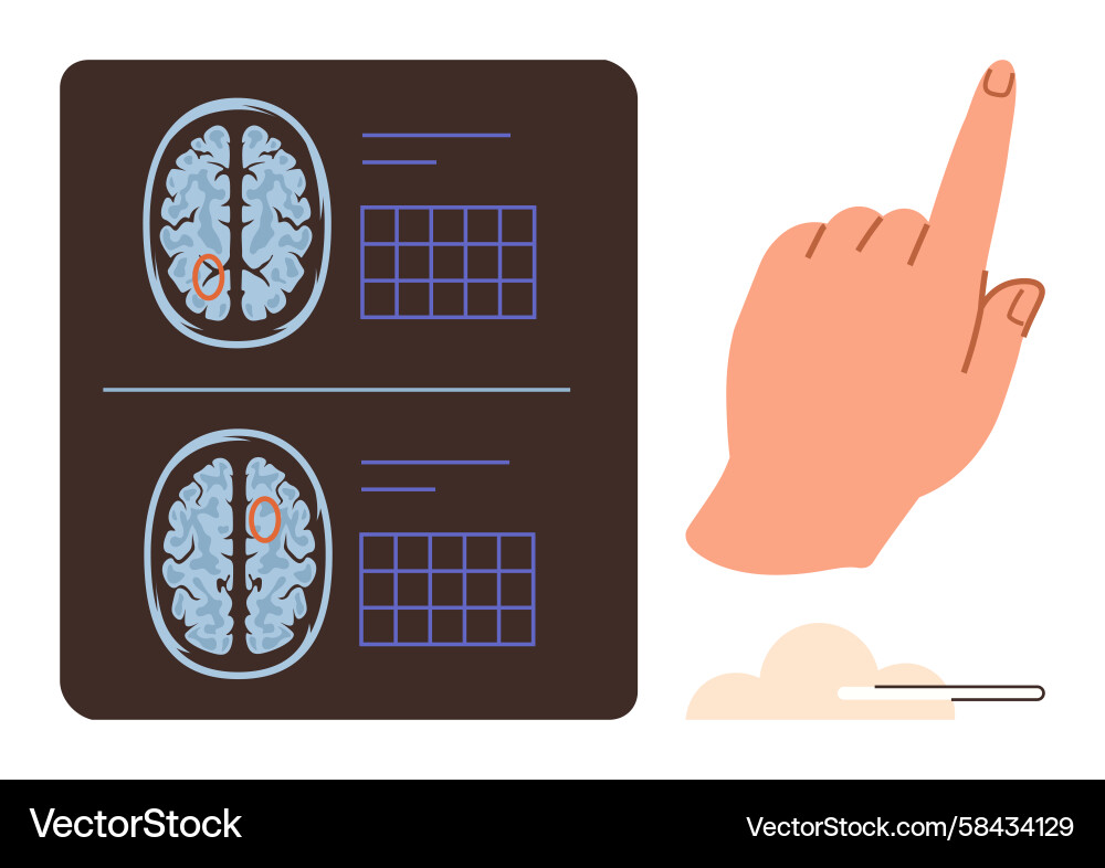 Brain Scan with Pointing Hand - Data Analysis Vector Image