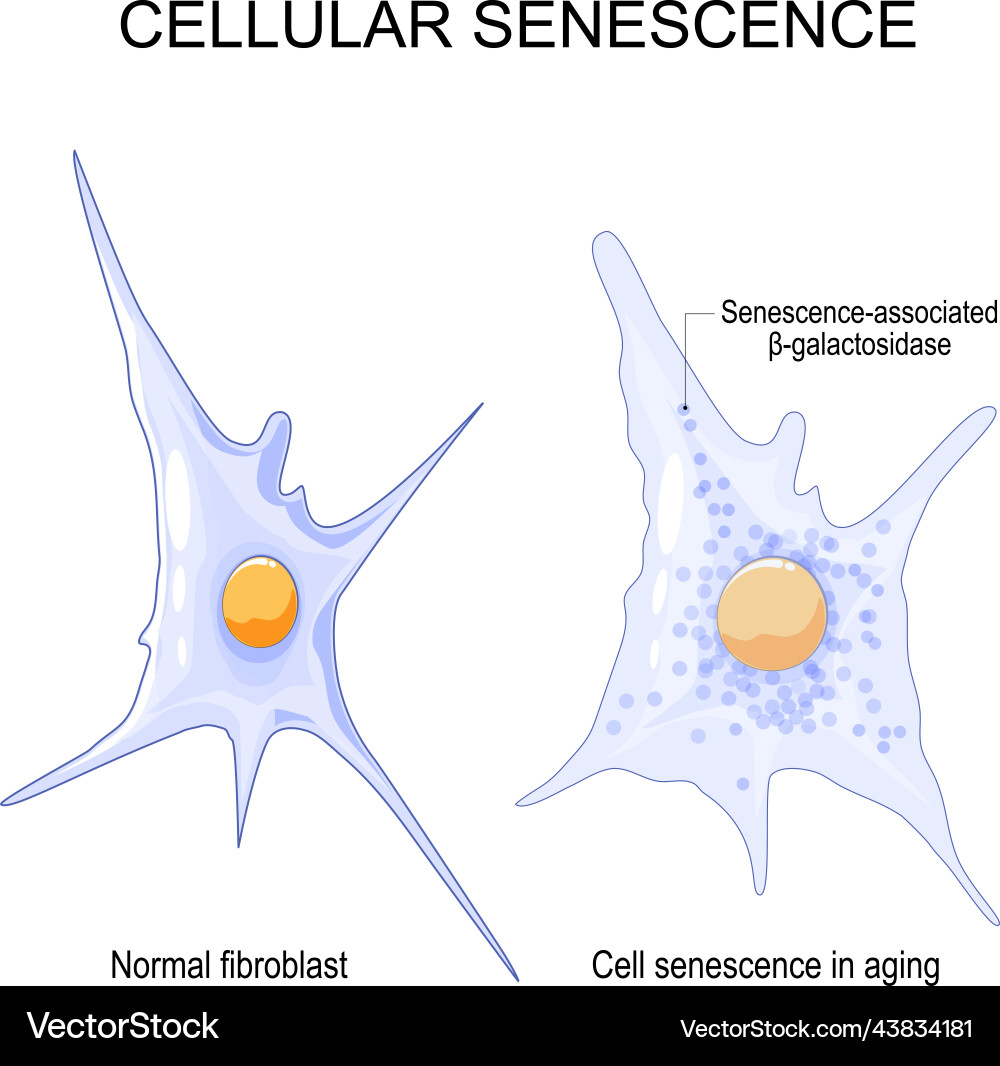 Changes senescent cells during ageing Changes senescent cells during ageing vector image