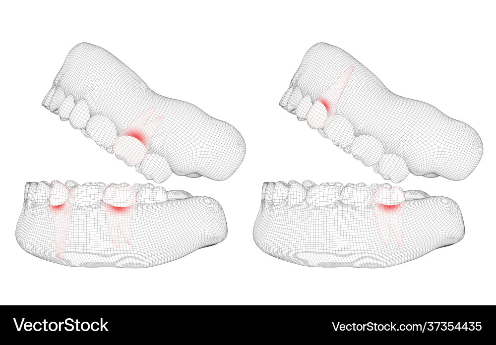Mensch Kiefer 3d Layout Medizin und Gesundheit Schmerz Zähne Mensch Kiefer 3d Layout Medizin und Gesundheit Schmerz Zähne vektorbild