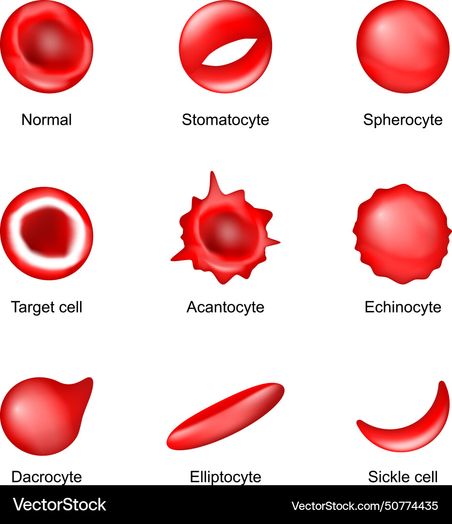 Shape Of Red Blood Cell Diseases Royalty Free Vector Image