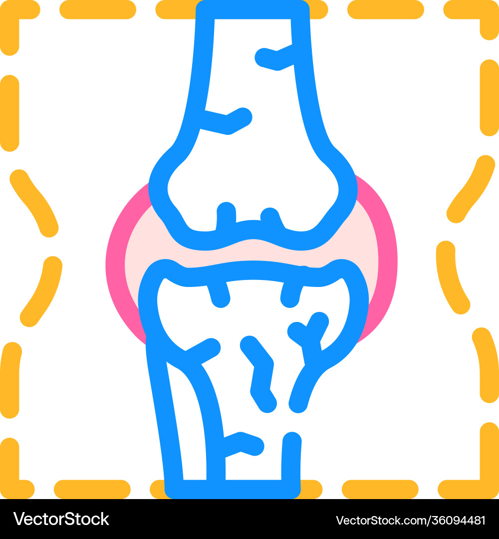 Joint problem color icon flat Vector Image