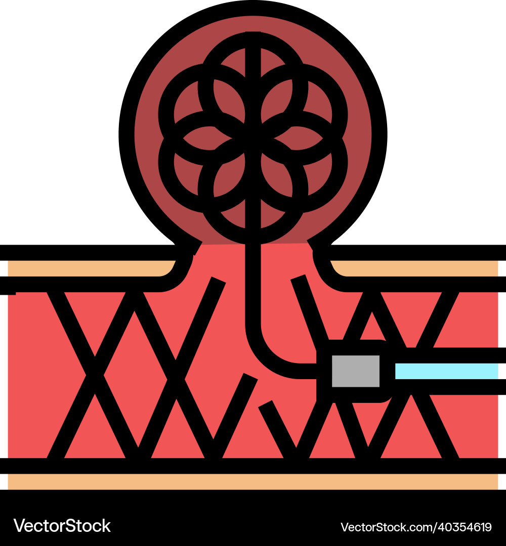 Coil embolization color icon Vector Image