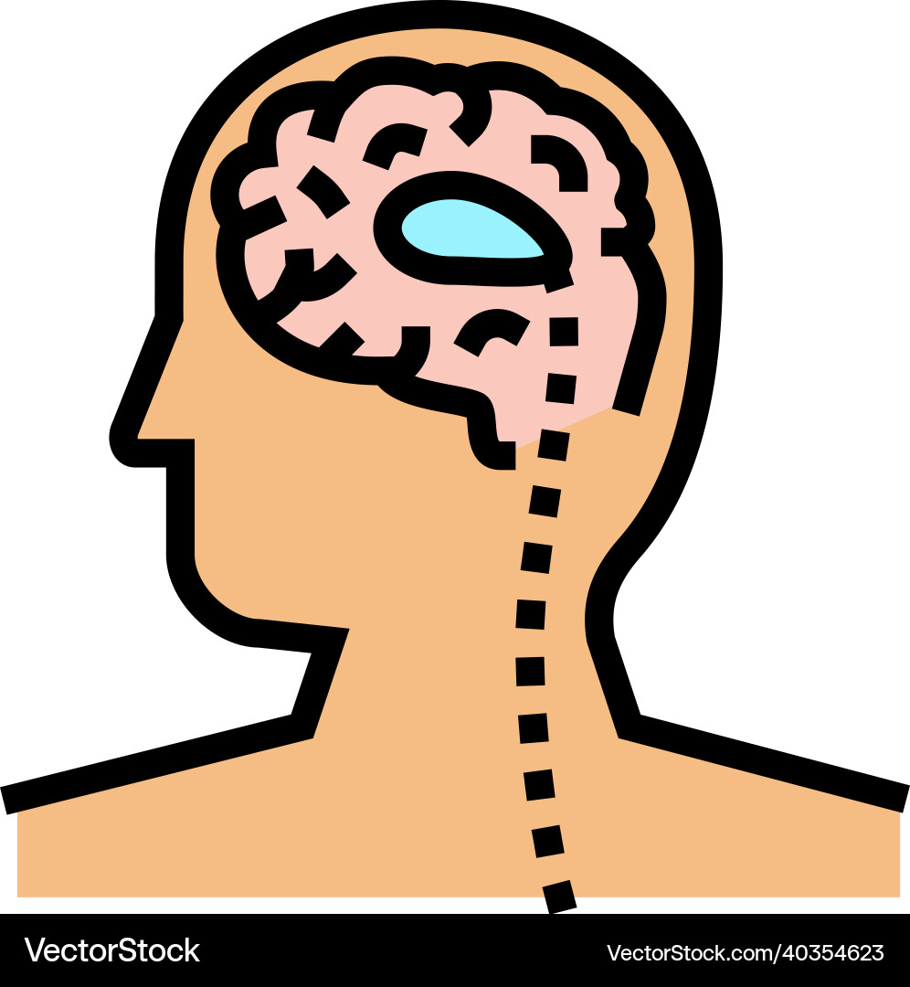 Shunt insertion or revision color icon Shunt insertion or revision color icon Vector Image