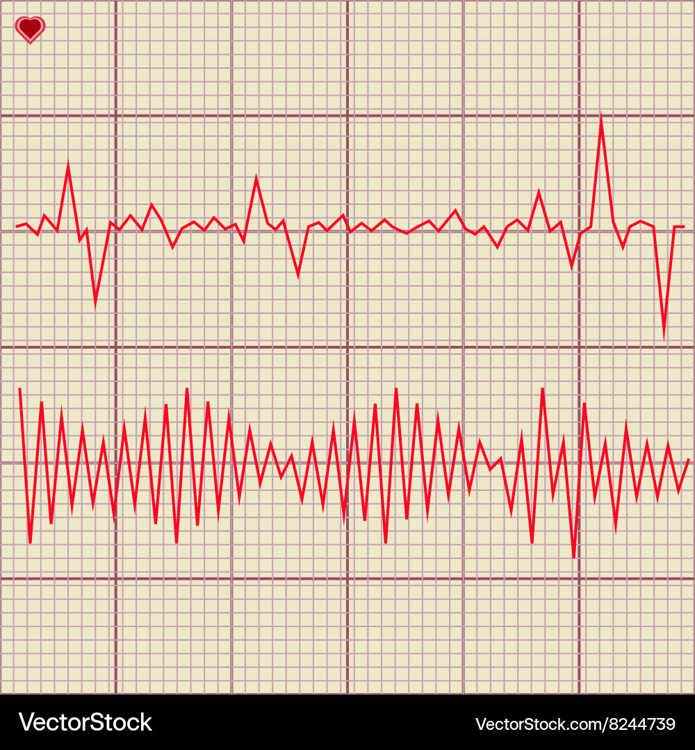 Set of various cardiogram design elements vector image
