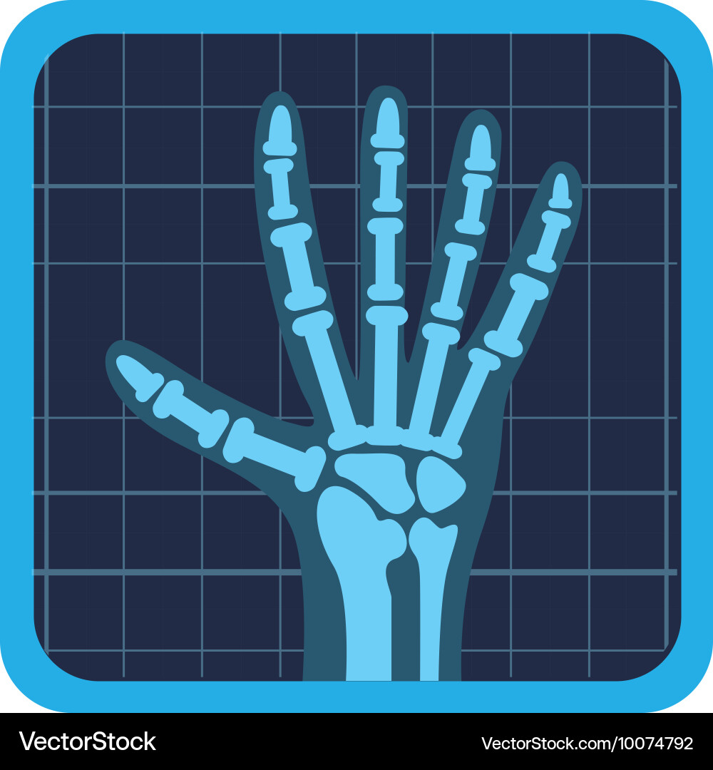 X rays test icon Vector Image