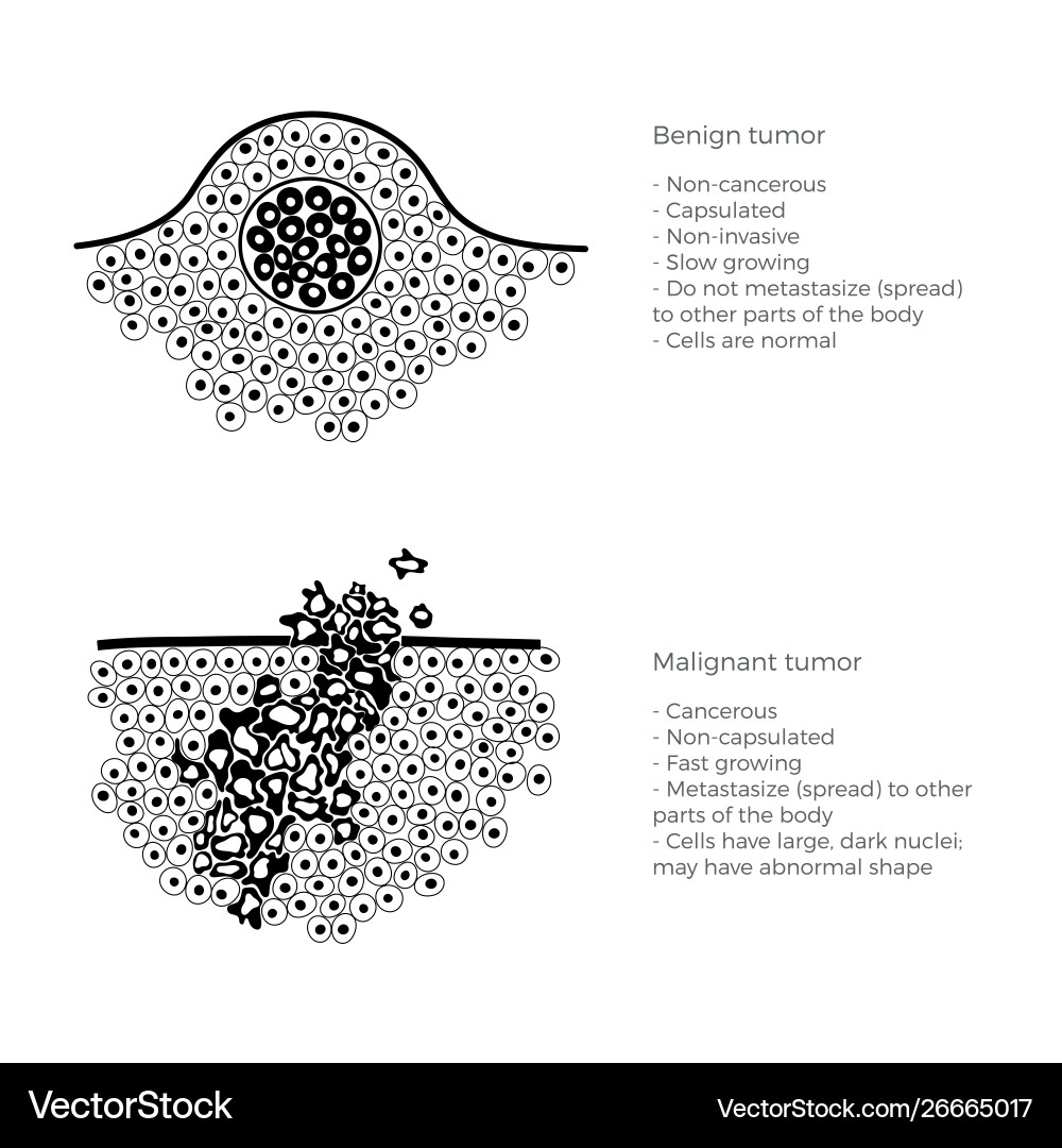 Cancer Cell Growth and Spread Vector Image