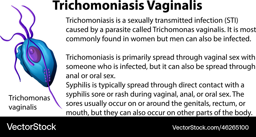Trichomoniasis vaginalis with explanation Trichomoniasis vaginalis with explanation Vector Image