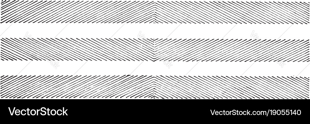Visual sloping lines etiologies but are often Vector Image