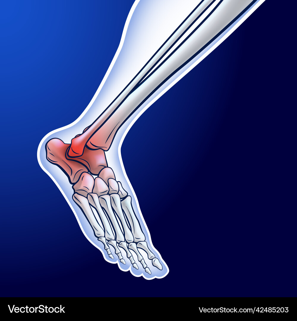 An of a running ankle bone showing red dots An of a running ankle bone showing red dots vector image
