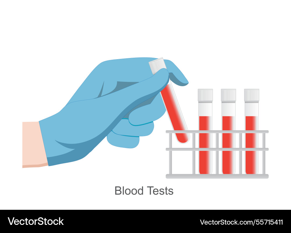 Blood tests is a broad spectrum test for problems Blood tests is a broad spectrum test for problems vector image