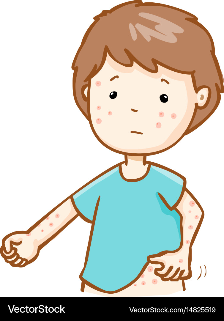 Man Suffering from Itching Rash Vector Image