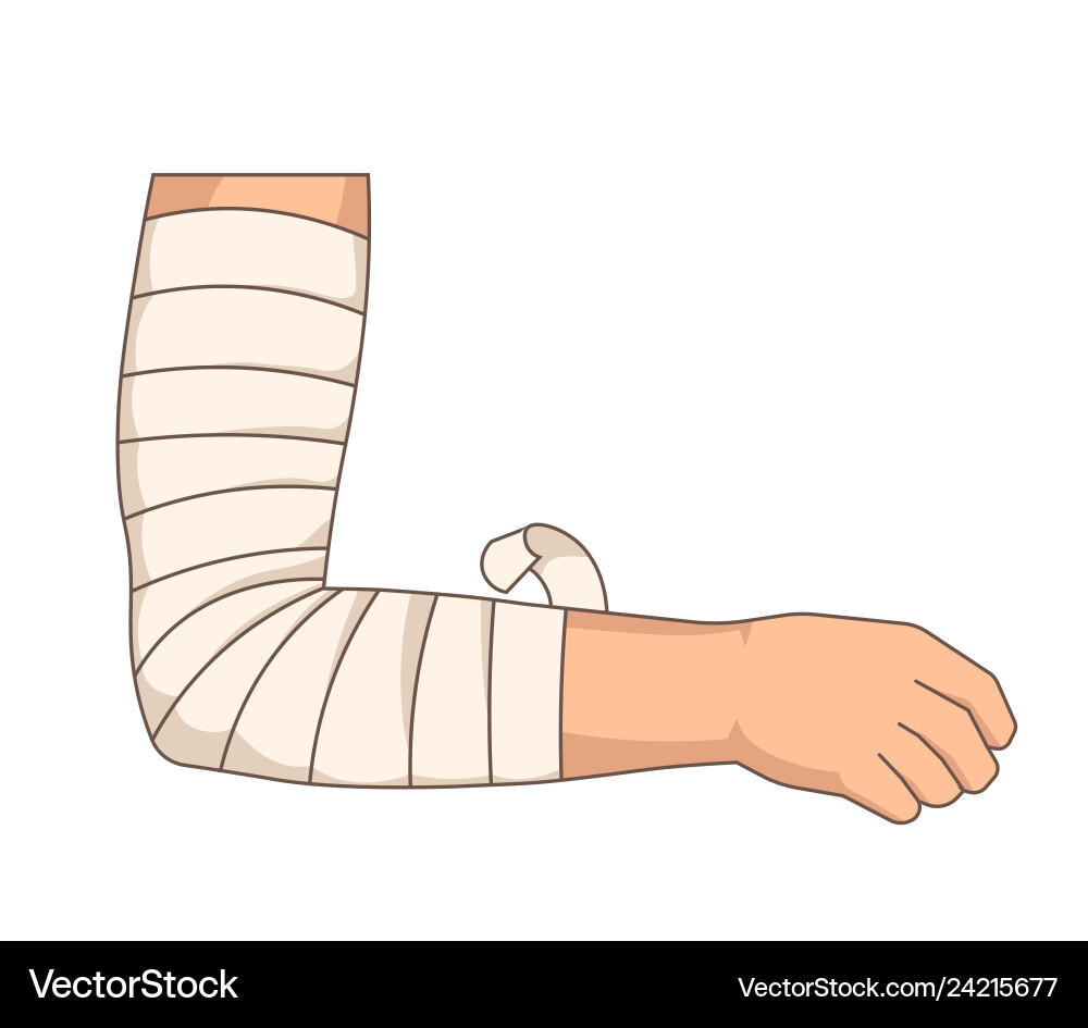 Bandage Ellbogen Verletzung Arm Bandage elastisches Band Bandage Ellbogen Verletzung Arm Bandage elastisches Band vektorbild