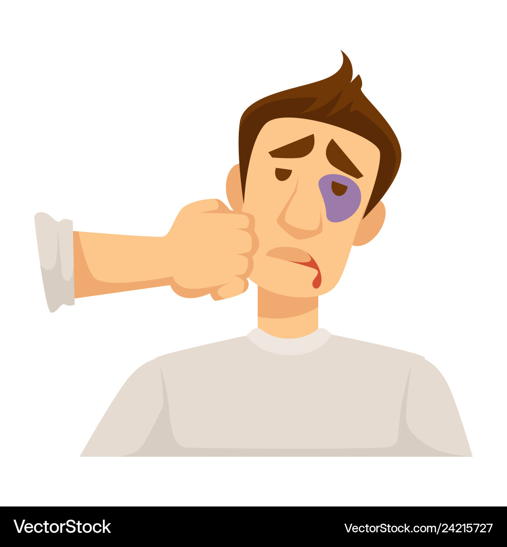 Punch in face injury bleeding lip and black eye Punch in face injury bleeding lip and black eye vector image