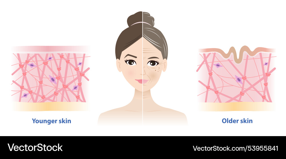 Difference between young and aging skin Royalty Free Vector