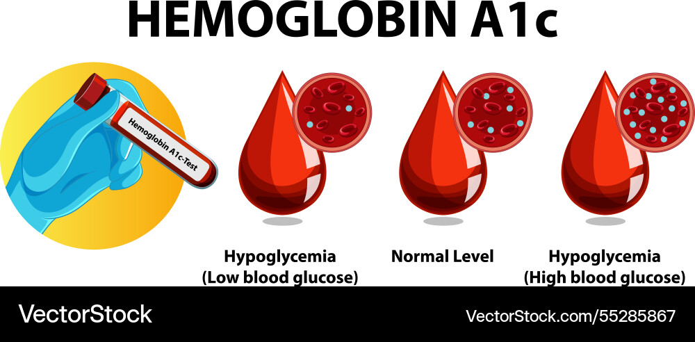 Blood glucose levels and testing Royalty Free Vector Image