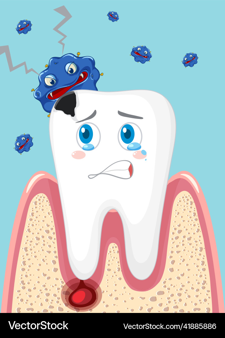 Cartoon tooth decay with bacteria on blue Cartoon tooth decay with bacteria on blue vector image